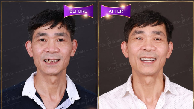 Slider image (2) Worldwide Dental & Cosmetic Surgery Hospital